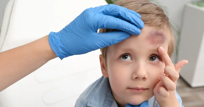A medical professional is examining a young child's forehead bruise and injury which requires a daycare injury liability investigation and documentation in Georgia.